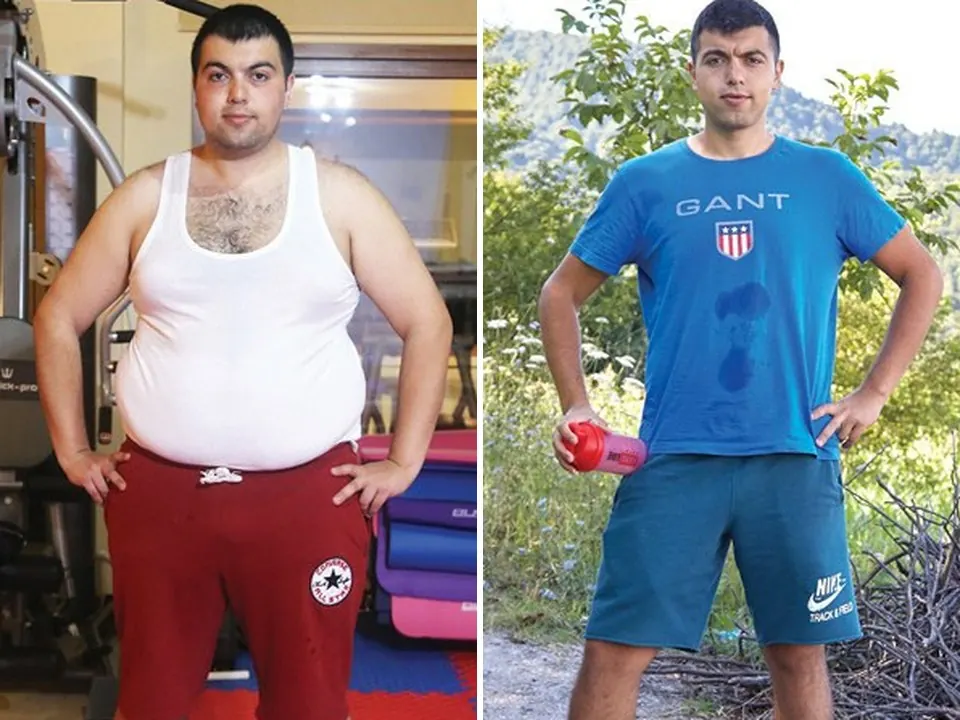 Alper — before and after