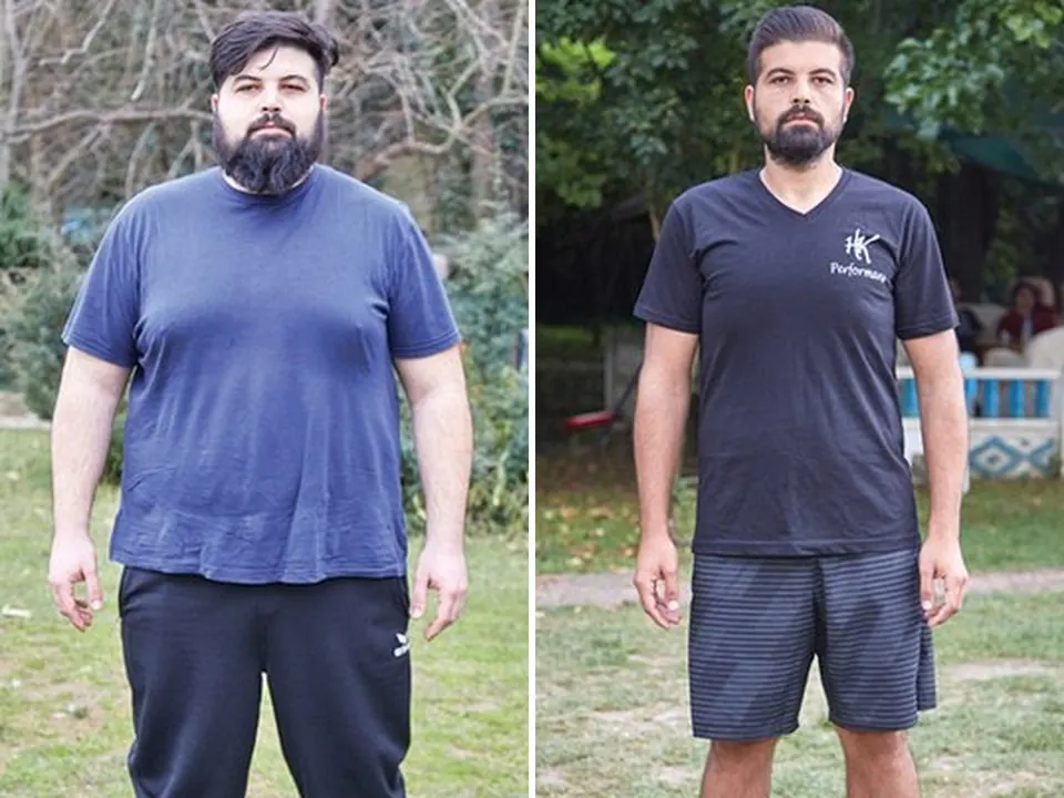 Burak — before and after