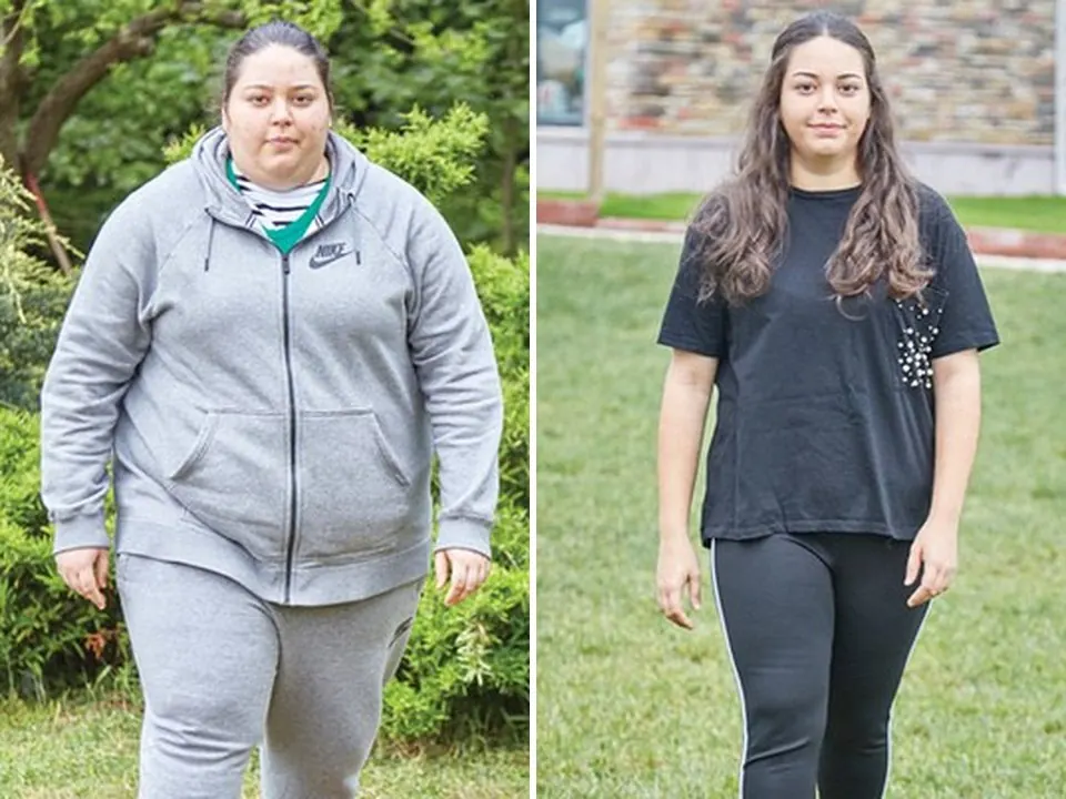 Ceyda — before and after