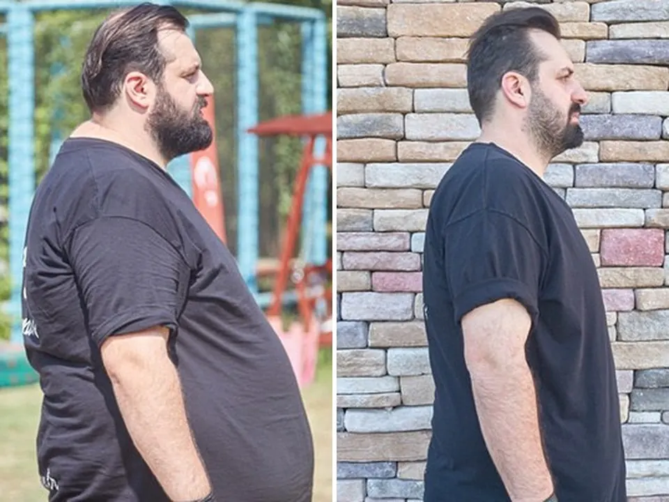 Fahri — before and after