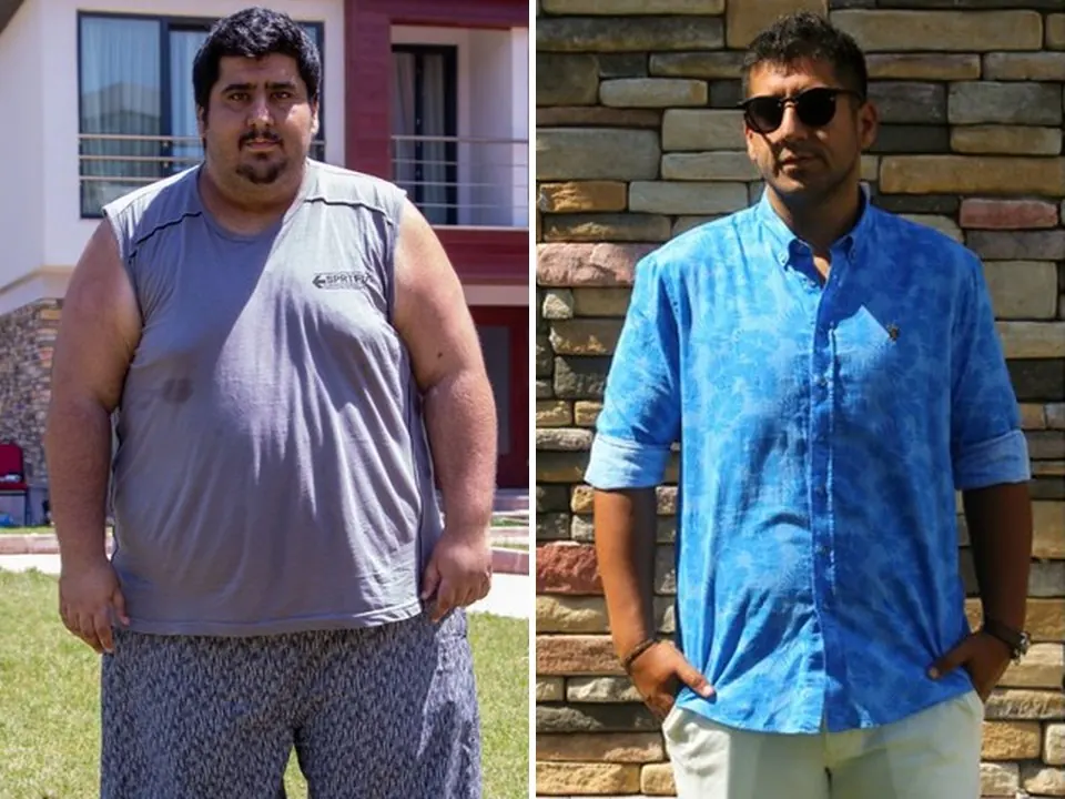 Hakan — before and after