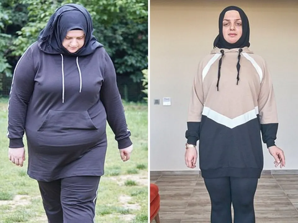 Merve — before and after