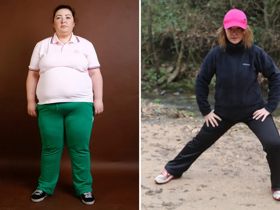 Sedef — before and after
